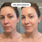 Revivo Wrinkle Eraser PDRN Peptide Serum