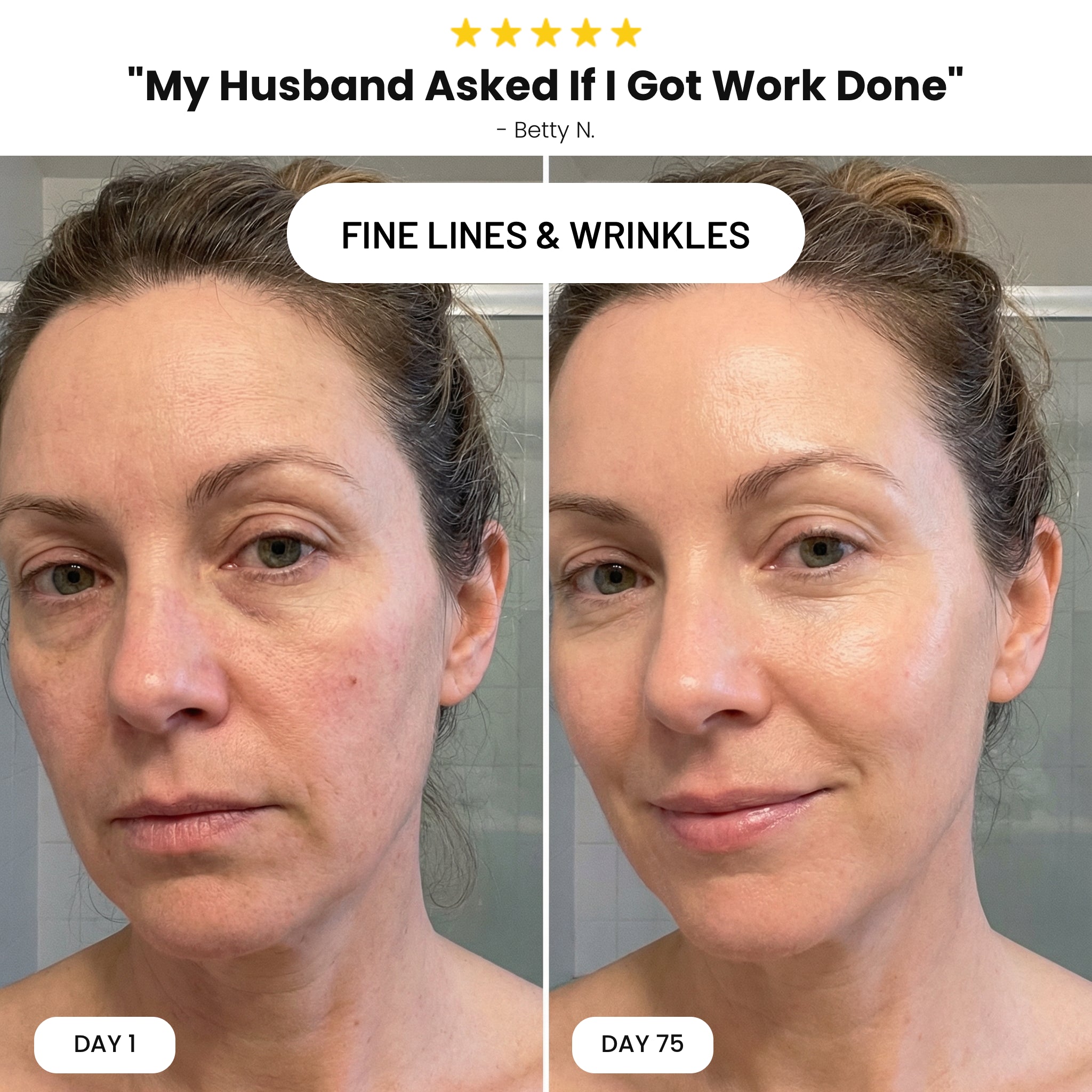 Revivo Wrinkle Eraser PDRN Peptide Serum