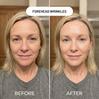 Revivo Wrinkle Eraser PDRN Peptide Serum