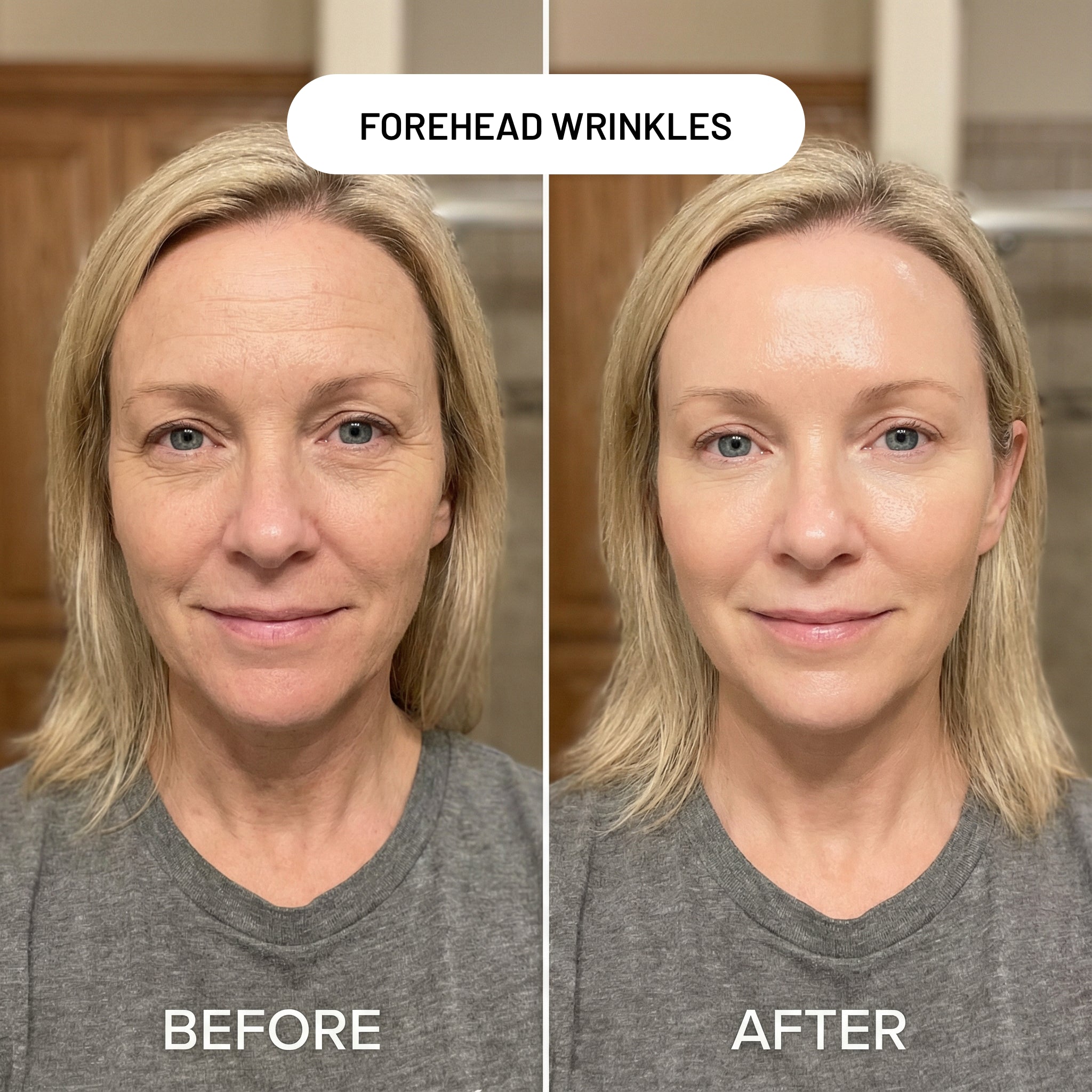 Revivo Wrinkle Eraser PDRN Peptide Serum