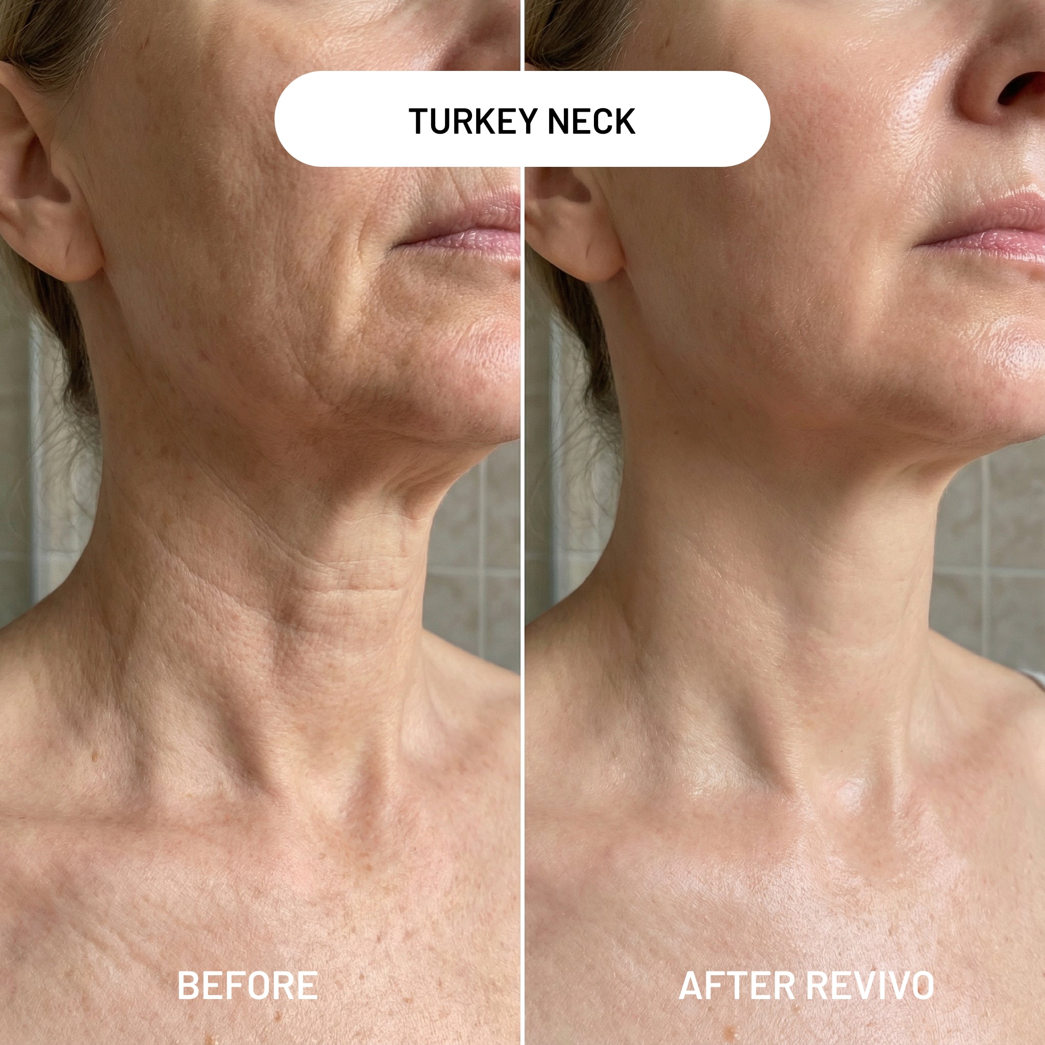 Revivo Wrinkle Eraser PDRN Peptide Serum