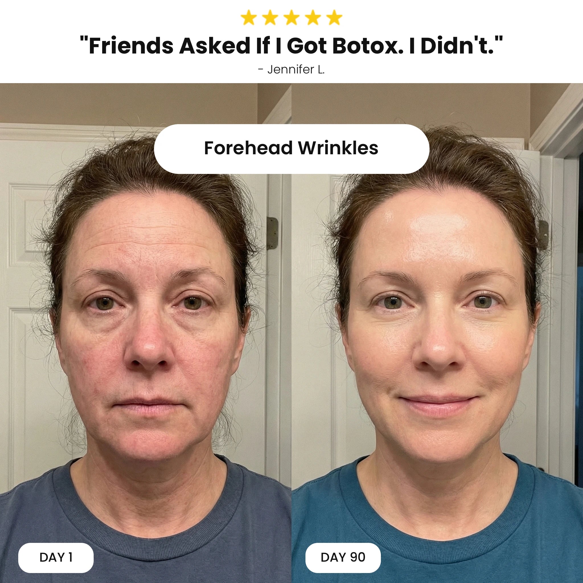 Revivo Wrinkle Eraser PDRN Peptide Serum