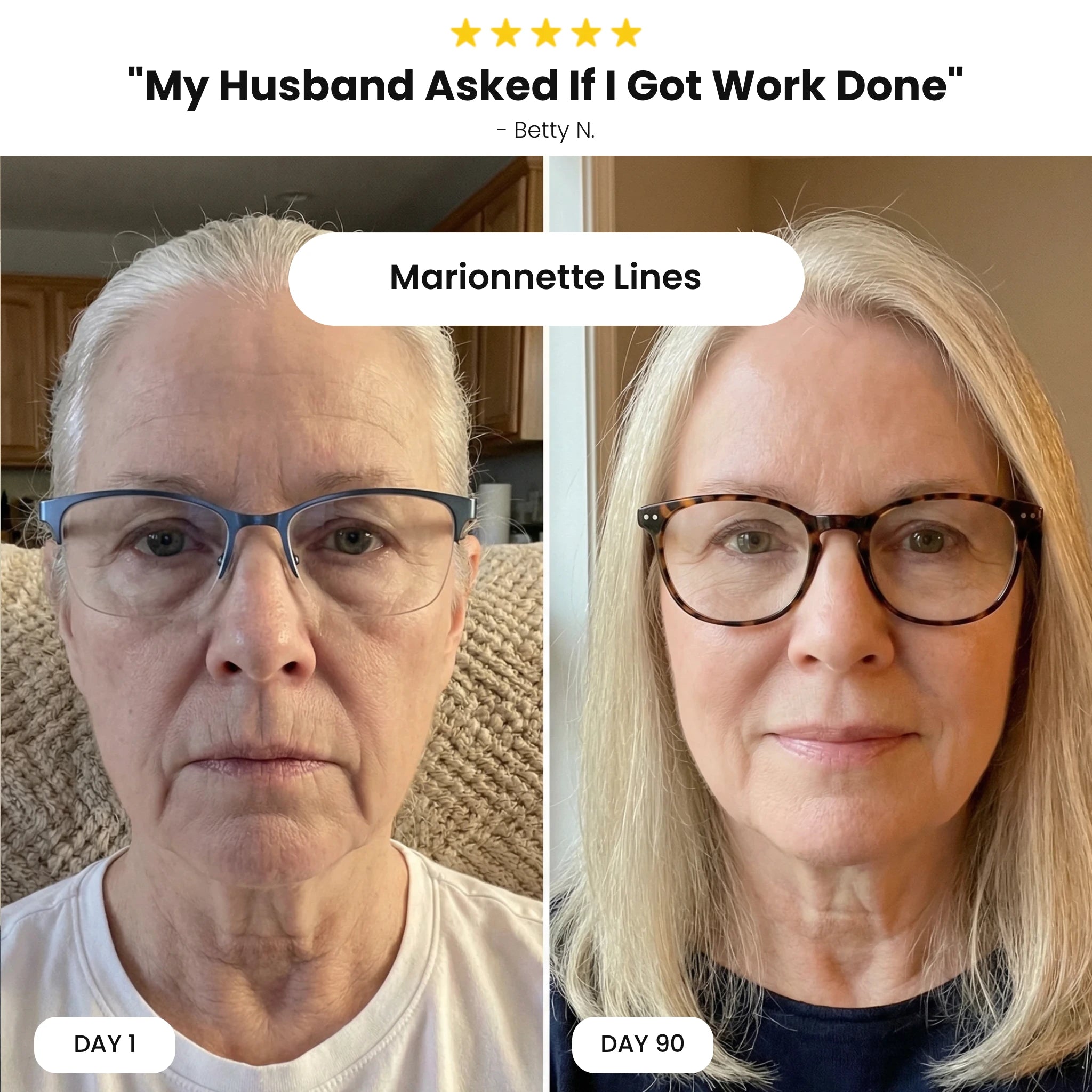 Revivo Wrinkle Eraser PDRN Peptide Serum